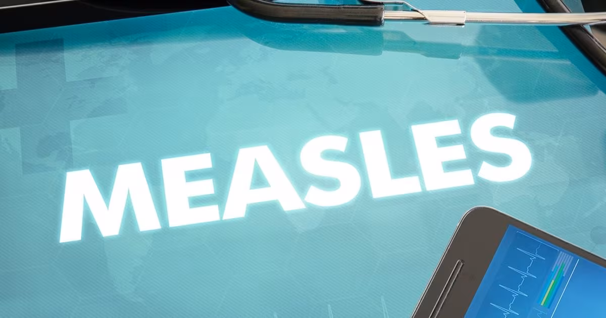You can track measles cases in WA through this map - The Seattle Times