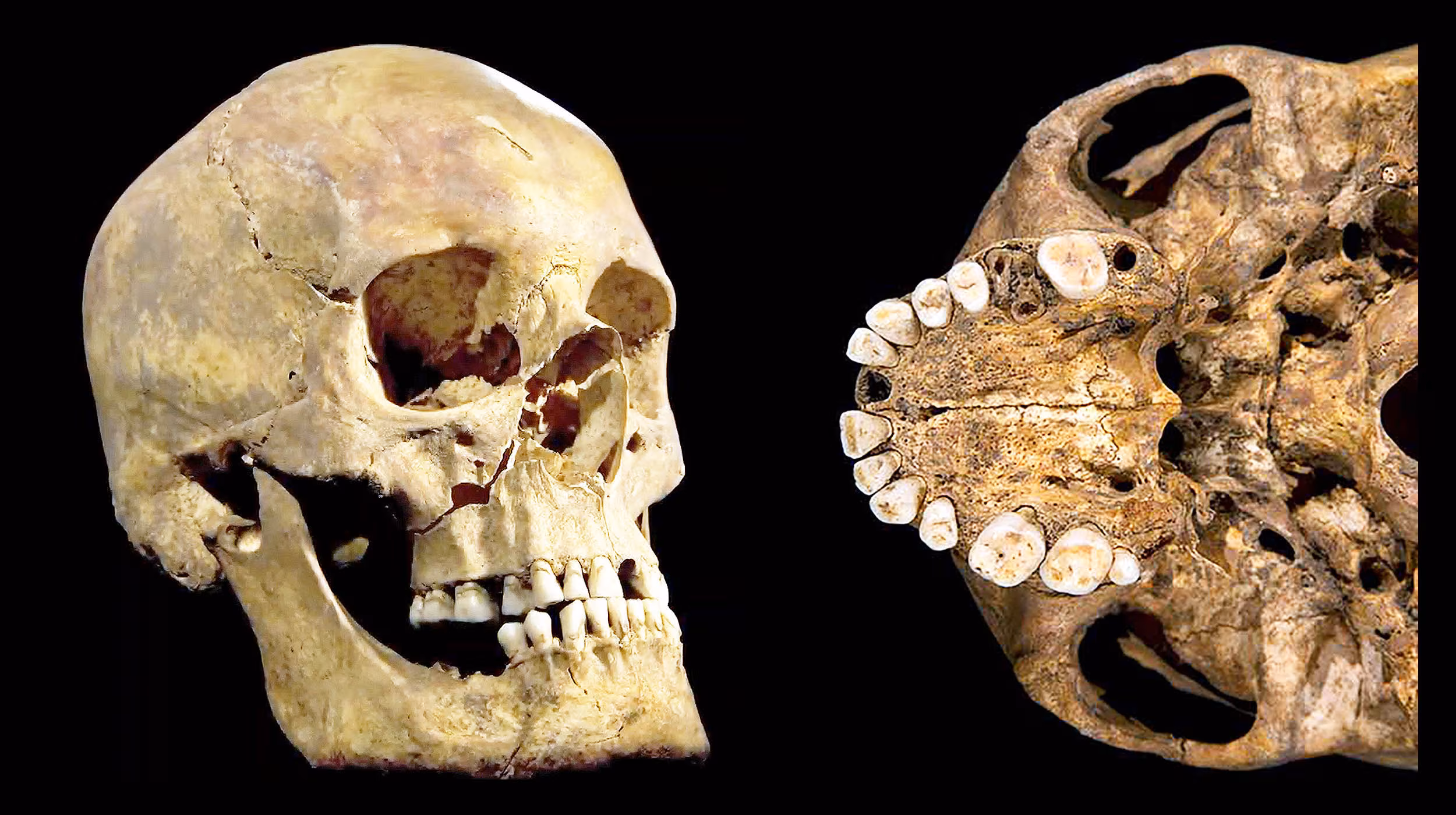 Archaeologists assemble King Richard III's microbiome using tooth plaque from 1485 - Earth.com