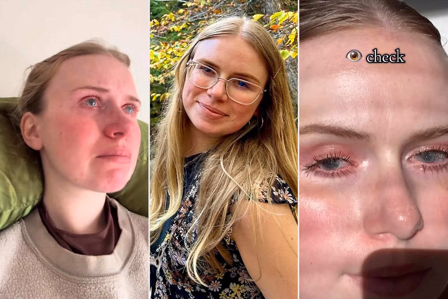 26-Year-Old Tearfully Documents Going Blind After Her Corneas 'Died Off': 'I Feel Powerless' (Exclusive) - Yahoo News Canada