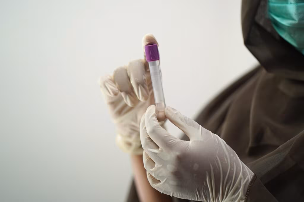 Close-up of blood test vials being processed in a medical laboratory for biomarker analysis.
