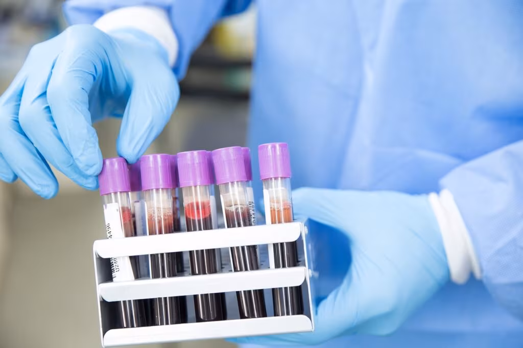 Medical scientist analyzing blood samples in a laboratory, symbolizing the clinical trials for the new cholesterol treatment.