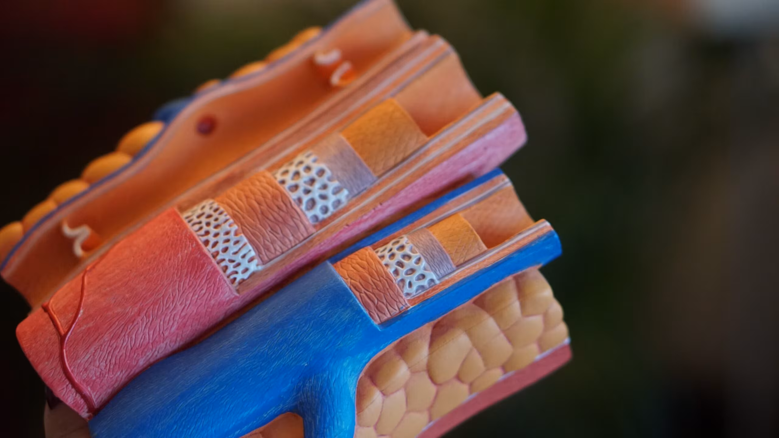 Stenting all blocked arteries outperforms culprit-only treatment approach, study shows - Medical Xpress